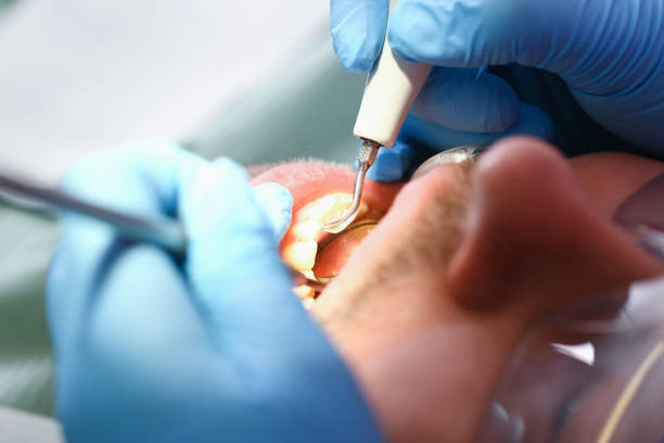 Best Emergency Treatment for Dental Infections or Abscesses in , MA